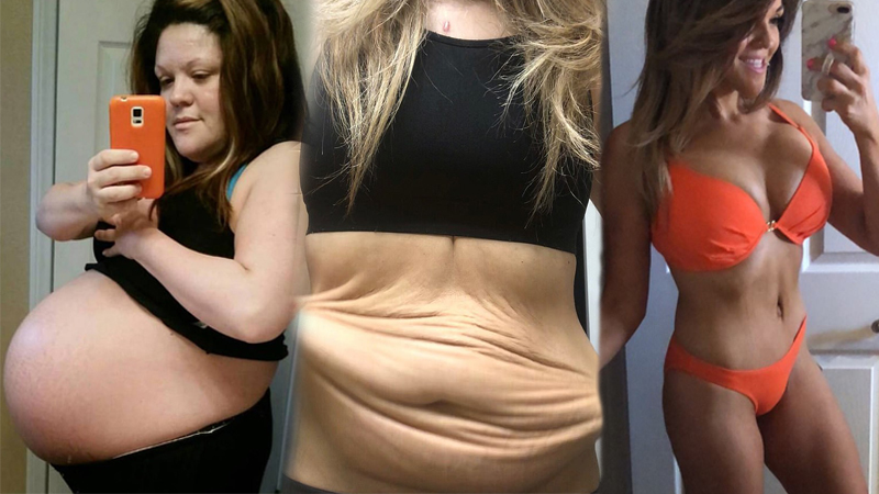 Melissa Bibeau ลดความอ้วน ลดน้ำหนัก ลดน้ำหนักหลังคลอด เปลี่ยนแปลงตัวเอง