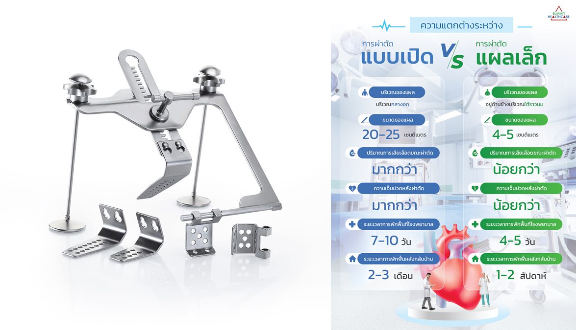 Cardiovascular MinimallyInvasiveSurgery SMHC SummitHealthcare