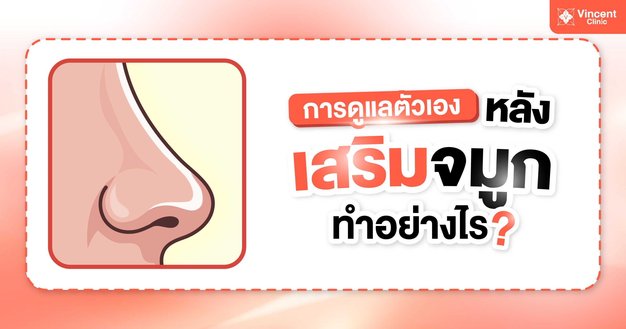 Vincent Clinic เสริมจมูก เสริมจมูก มีกี่เทคนิค