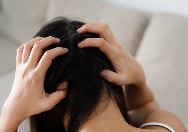 สระผม แพ้แชมพู